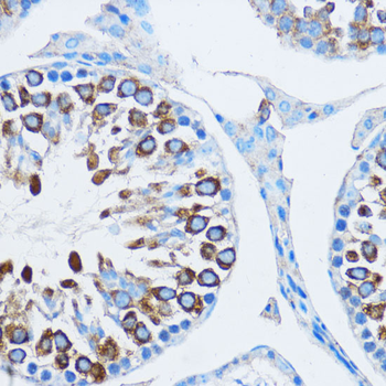 YBX1 antibody