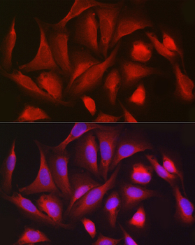 PGD antibody