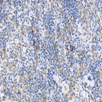 SOCS1 antibody