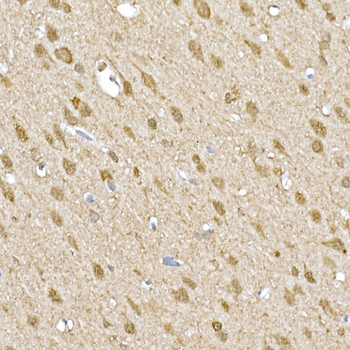 SOCS1 antibody