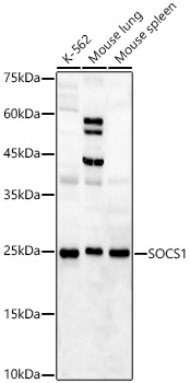 SOCS1 antibody