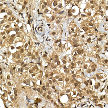 SQSTM1 antibody