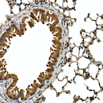 SQSTM1 antibody