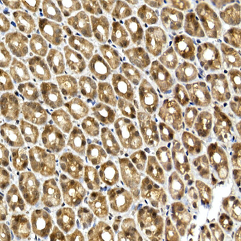 SQSTM1 antibody