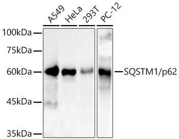 SQSTM1 antibody