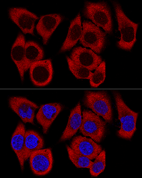 RPL36 antibody