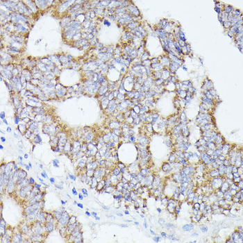 ACAT2 antibody