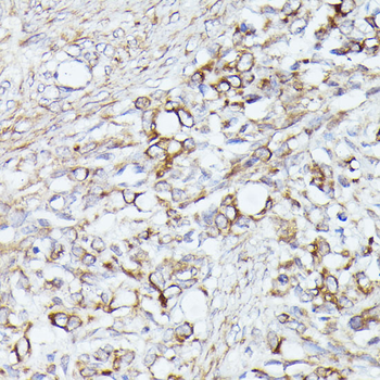 ACAT2 antibody