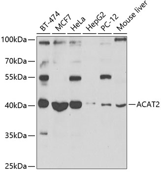 ACAT2 antibody