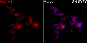 NCAM1 antibody