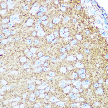 NCAM1 antibody