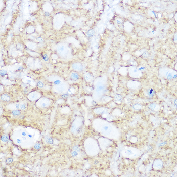 NCAM1 antibody