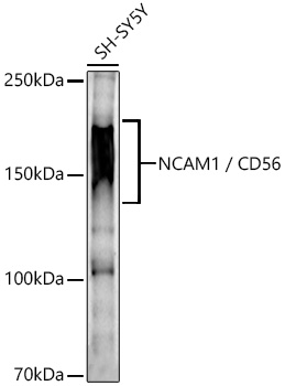 NCAM1 antibody