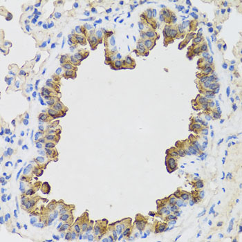 B9D1 antibody