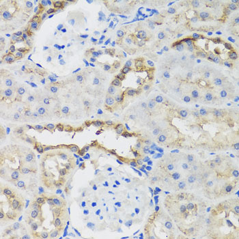 B9D1 antibody