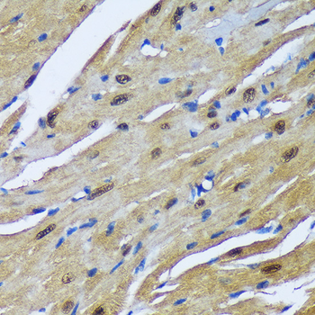 MBNL1 antibody