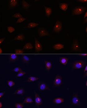 CETN3 antibody