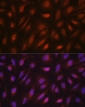 CETN3 antibody