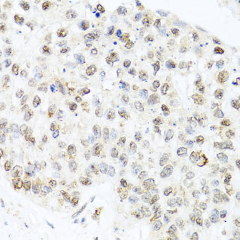 CETN3 antibody