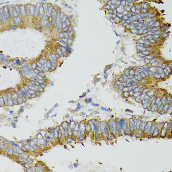 ND5 antibody