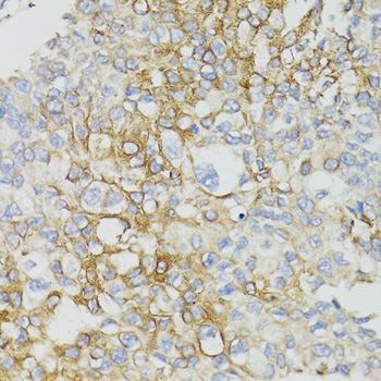 ND5 antibody