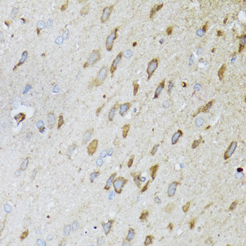 ND5 antibody