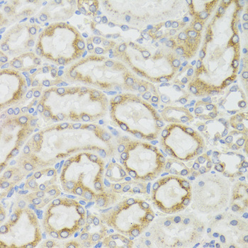 ND5 antibody