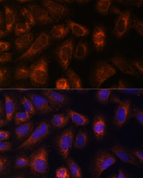 CAD antibody