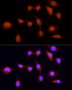 KPNA3 antibody