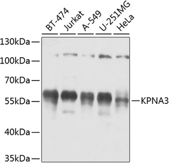 KPNA3 antibody