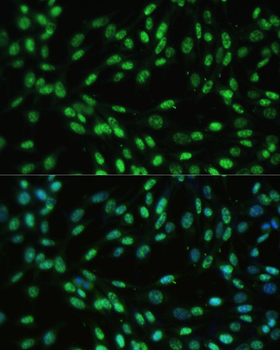 DDX39B antibody