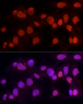 METTL3 antibody