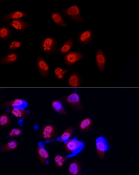 METTL3 antibody