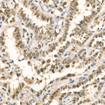 METTL3 antibody