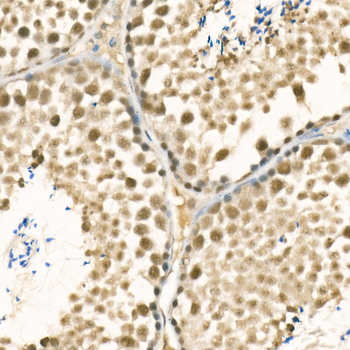 METTL3 antibody