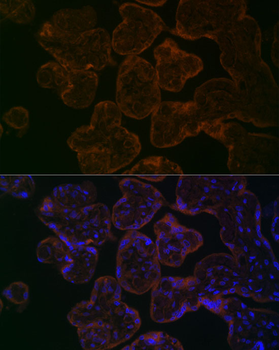 MYO5B antibody