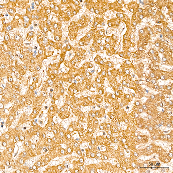 GCDH antibody