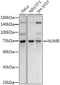 NUMB antibody