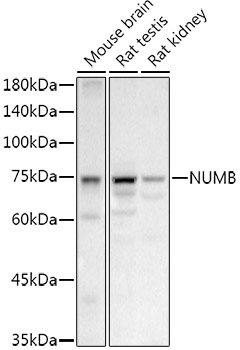 NUMB antibody