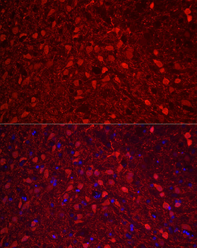 CALB2 antibody