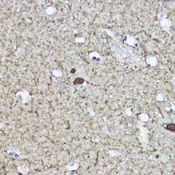 CALB2 antibody