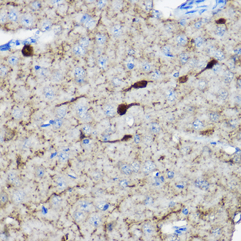 CALB2 antibody