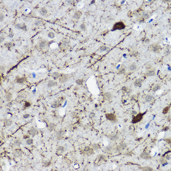 CALB2 antibody