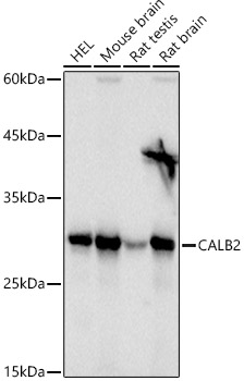 CALB2 antibody