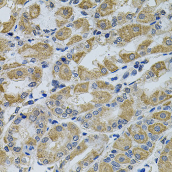 PTK7 antibody