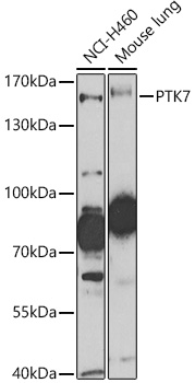 PTK7 antibody