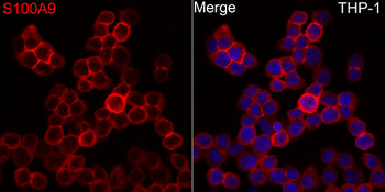 S100A9 antibody