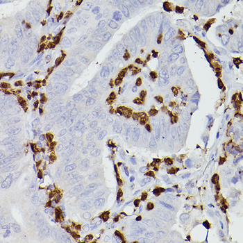 S100A9 antibody