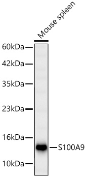 S100A9 antibody