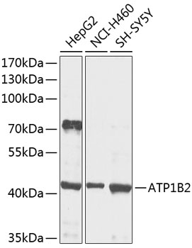 ATP1B2 antibody